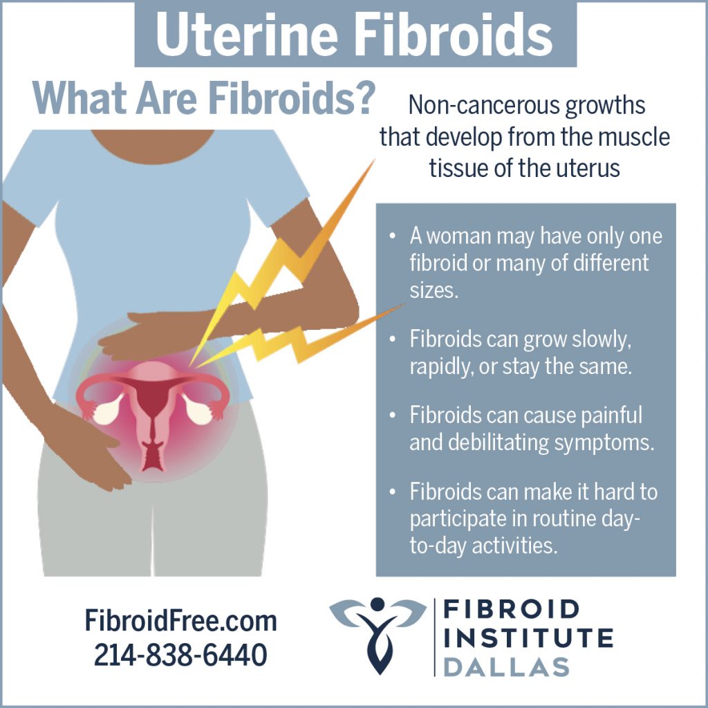 What Are Fibroids