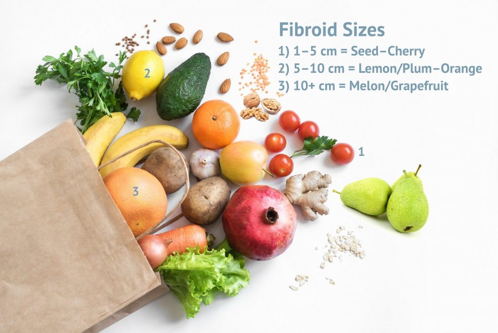 Fibroids and weight gain fibroid sizes