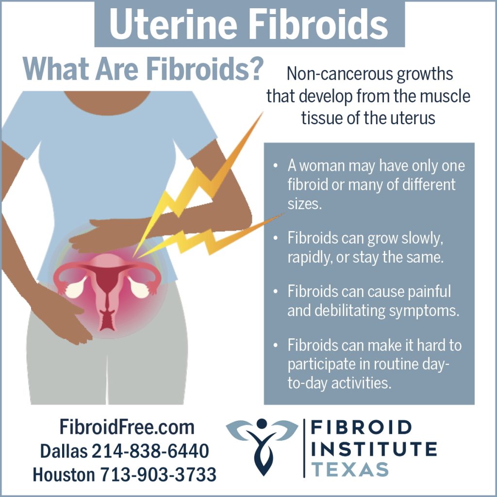 What are fibroids infographic Fibroid Institute Texas