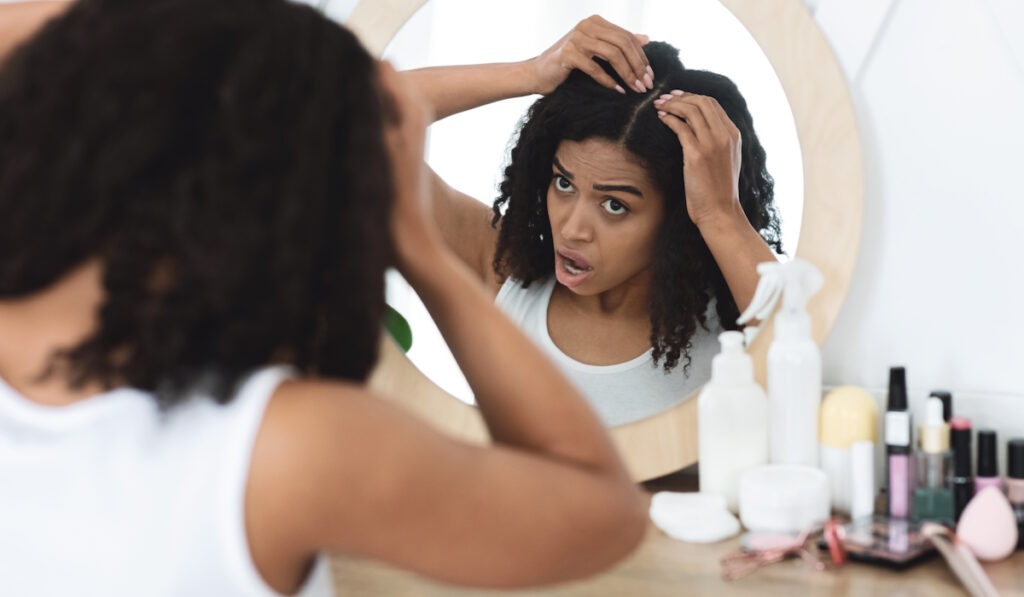 fibroid symptoms hair loss bald spot