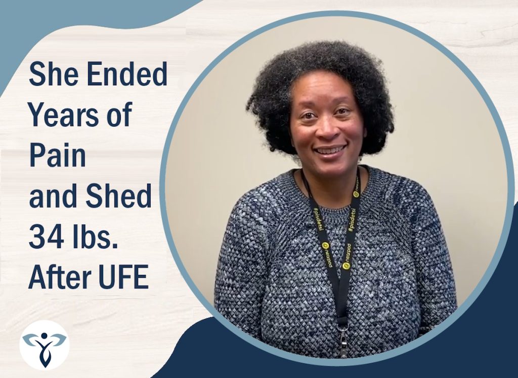 patient story teacher ended years of pain lost weight after ufe