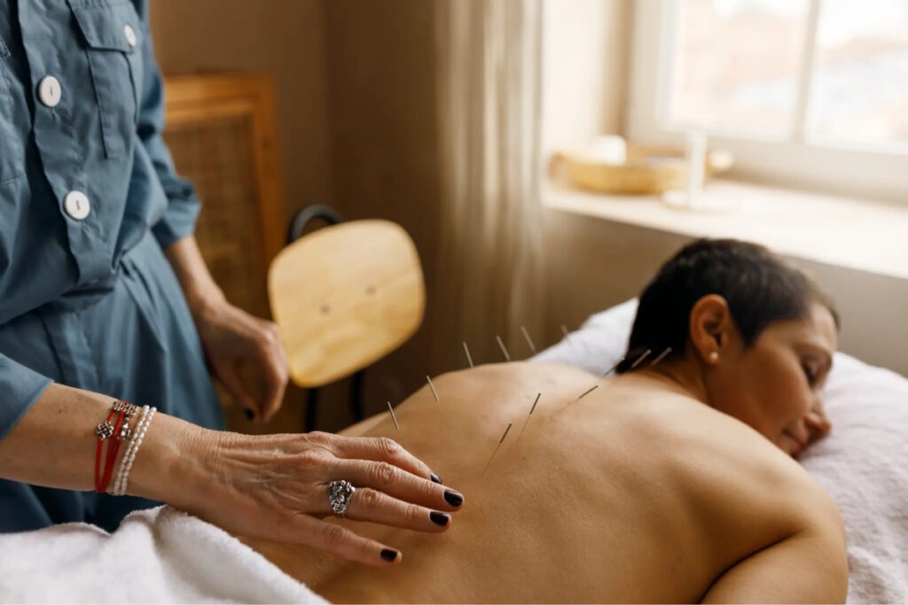 uterine fibroids woman relaxing with acupuncture