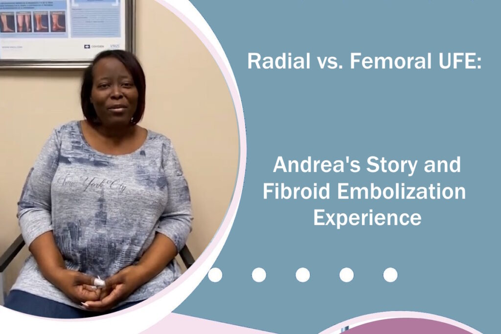 ufe fibroid embolization radial ufe fermoral ufe patient story andrea
